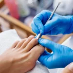 10 Herramientas Esenciales para Podólogos: Guía Completa