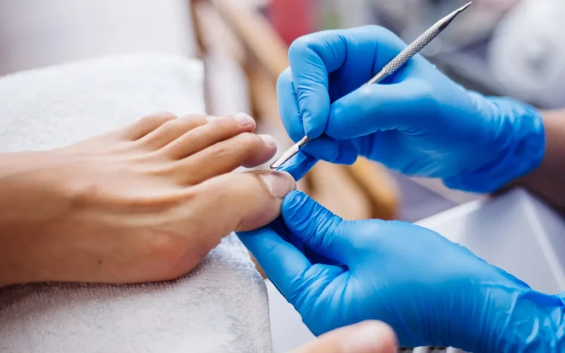 Cómo Lograr un Pedicure Perfecto: Consejos para Pies Sanos y Hermosos